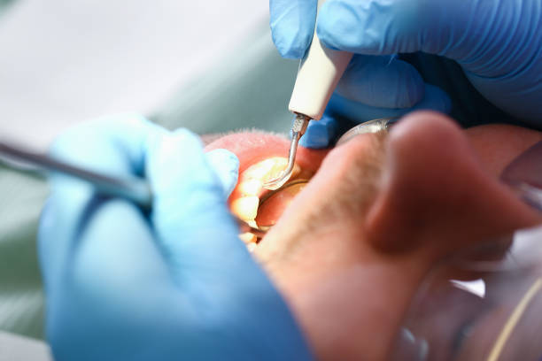 Best Emergency Root Canal Treatment in Mcfarland, WI