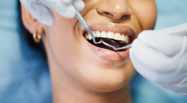 Best Broken or Cracked Tooth Emergency Dentist in Mcfarland, WI